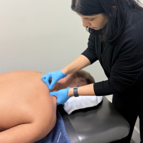 dry-needling-Mt-Lehman-Physiotherapy-Clinic-Abbotsford-BC