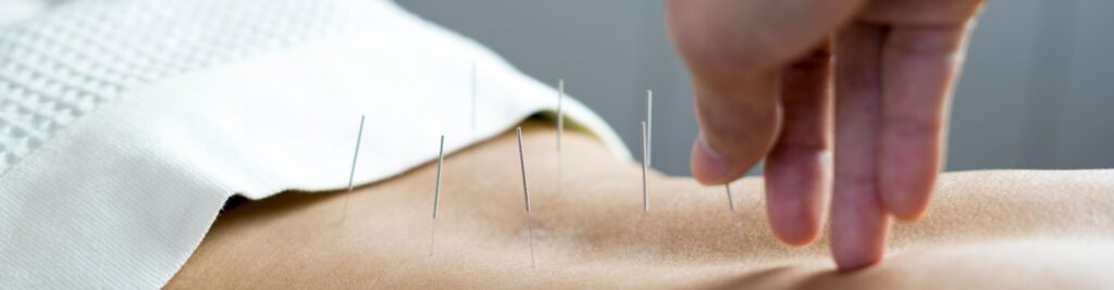 acupuncture-Mt-Lehman-Physiotherapy-Clinic-Abbotsford-BC-1920x500